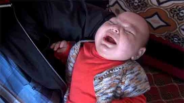 Epilepsi Bebek Belirtileri ve Tedavisi Epilepsi Bebek Belirtileri ve Tedavisi